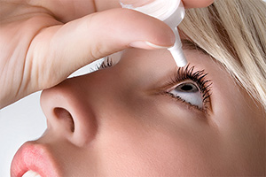 Frau verwendet Augentropfen gegen ihre Allergiesymptome